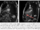 This AI Paper Explains the Effect of Data Augmentation on Deep-Learning-based Segmentation of Long-Axis Cine-MRI